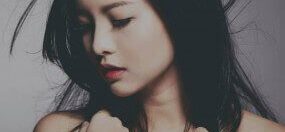 ham thẩm mỹ từ mắt lành thành mắt què