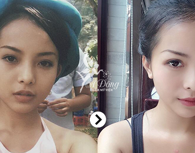 Trắng da mặt Stem Cell White Skin