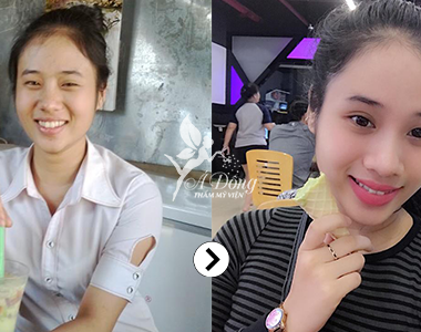 Trắng da mặt Stem Cell White Skin