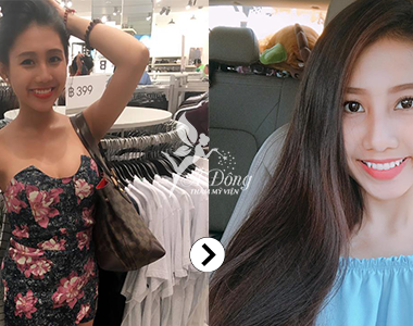 Trắng da mặt Stem Cell White Skin