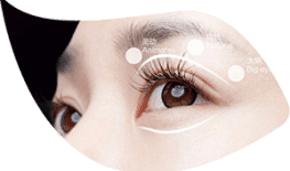 TẠO HÌNH MÍ DO SỤP CƠ