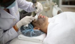 ĐIỀU TRỊ ĐỒI MỒI, TÀN NHANG BẰNG FRACTIONAL CO2