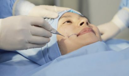 Đo vẽ và đánh dấu