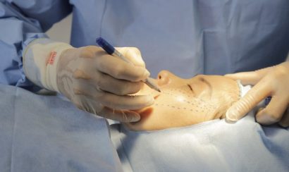 Đo vẽ vùng da cần căng