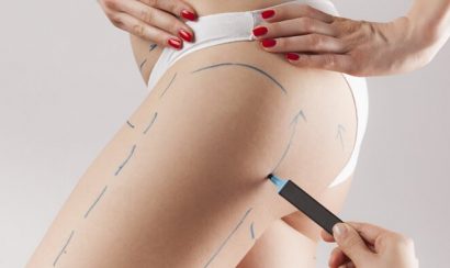 Đo vẽ tính toán tỷ lệ phù hợp