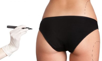 đo vẽ tỷ lệ phù hợp