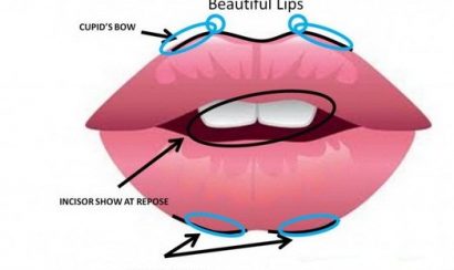 Xác định tỉ lệ phù hợp