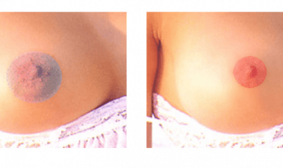 Tiến hành phun nhũ hoa