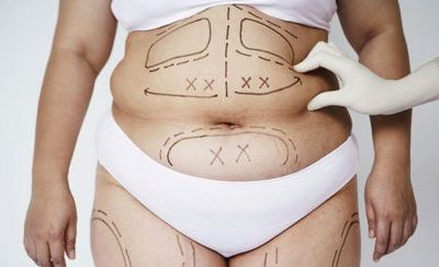 Đo vẽ, xác định tỷ lệ phù hợp