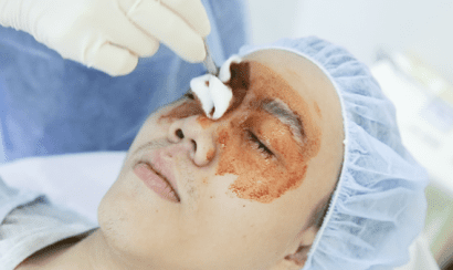 Sát khuẩn vùng mí mắt