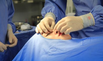 Nạo và lấy SILICON từ phần mũi