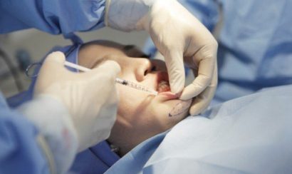 Gây tê và sát trùng