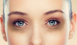 CHỈNH SỬA MẮT TRỢN MÍ DƯỚI