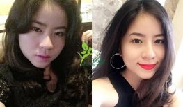 CHỈNH SỬA CHÂN MÀY HƯ