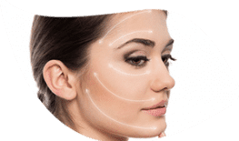 CĂNG DA MẶT TOÀN PHẦN