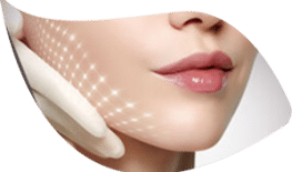 TẠO CẰM VLINE 3D MIGANIT