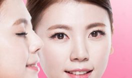 ĐẶT SỤN VÙNG TRÁN