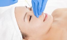 NÂNG MŨI BẰNG FILLER