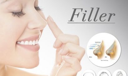xác định tỉ lệ filler