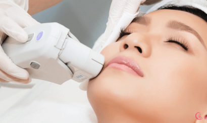 Dùng máy triệt nông tác động lên vùng trị liệu